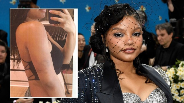 Halle Bailey on the red carpet, and another photo of her bruised arm.