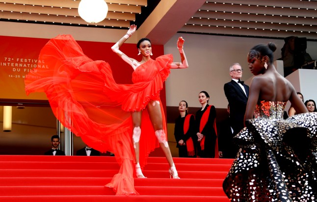 72nd Cannes Film Festival - Screening of the film "Once Upon a Time in Hollywood" in competition - Red Carpet Arrivals - Cannes, France, May 21, 2019. Winnie Harlow poses. REUTERS/Eric Gaillard